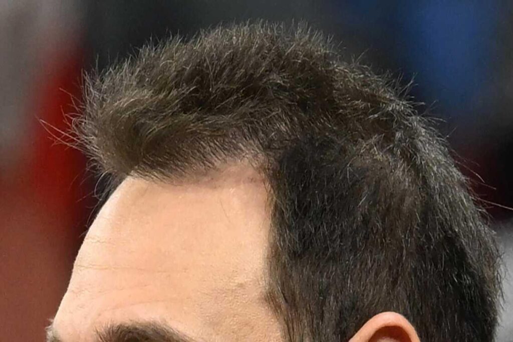 EA7 Milano cade in casa contro la Stella Rossa: una sconfitta sorprendente in Eurolega